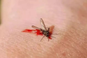 蚊子咬了怎么消肿止痒最快