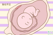 怀孕多久胎位就稳固了 正常的胎位是什么胎位